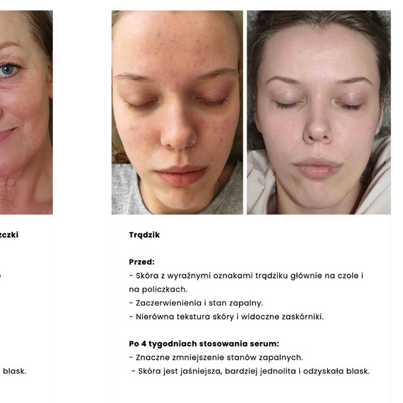 Nature Cosmetics - Nature Skin Serum - Serum ze śluzem ślimaka 98% - 10 g